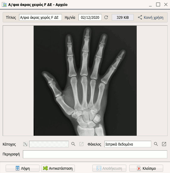 Εικόνα ακτινογραφίας καταχωρημένη στο ιατρικό πρόγραμμα Γαληνός Office